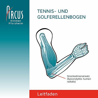Behandlungsleitfaden Tennis- und Golferellenbogen