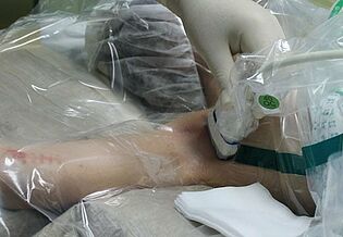 Vorbereitung der Teilnarkose für eine Ellenbogen-OP per Ultraschall