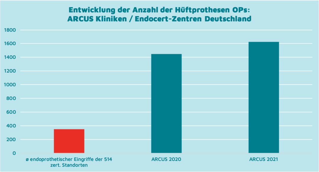 Entwicklung der Anzahl der Hüftprothesen OPs:  Anzahl der Hüft-TEP OPs in den ARCUS Kliniken im Vergleich zum durchschnittlichen Gesamtwert sämtlicher endoprothetischen Eingriffe (z.B Hüftprothesen, Knieprothesen usw.) aller Endocert-Zentren in Deutschland